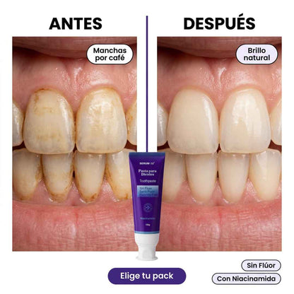SERUM 10 PASTA DENTAL - RECUPERA EL BRILLO DE TUS DIENTES