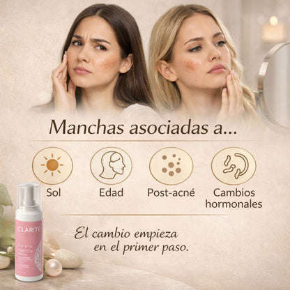CLARITÉ DESPIGMENTANTE ACLARADOR — MEJORAR LA APARIENCIA DE MANCHAS — PLAN 30 DÍAS