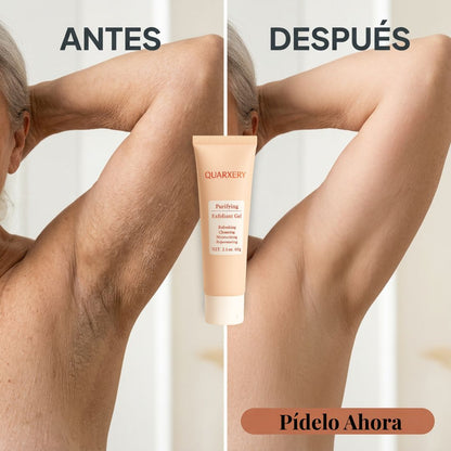 QUARXERY PURIFYING GEL - RENUEVA TU PIEL OPACA Y CARGADA